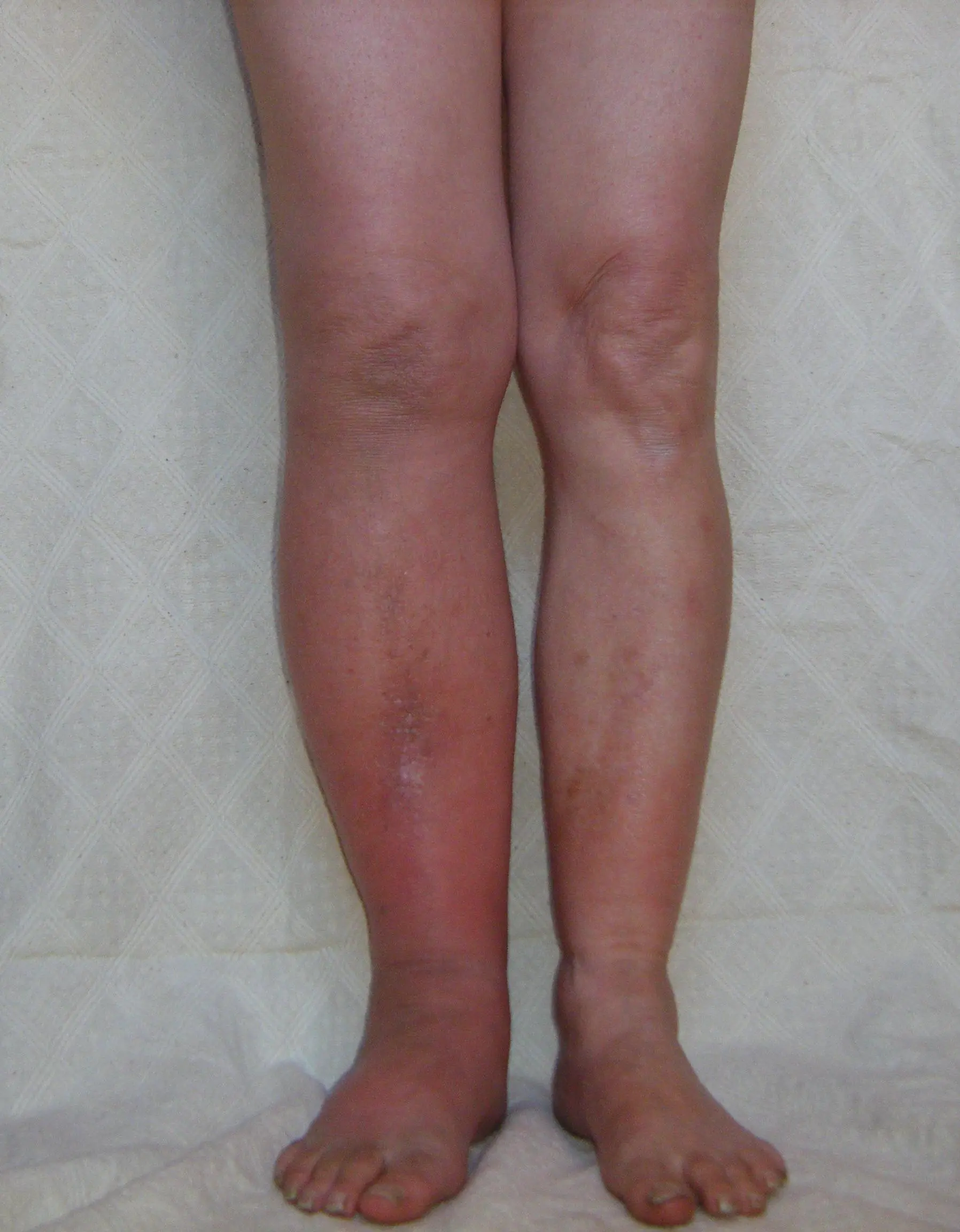 <Matching pair of legs